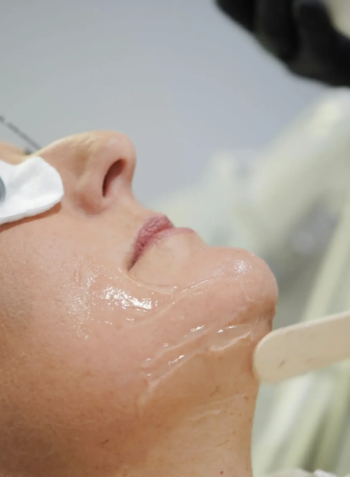 does ipl actually work