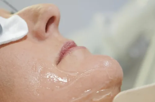 does ipl actually work