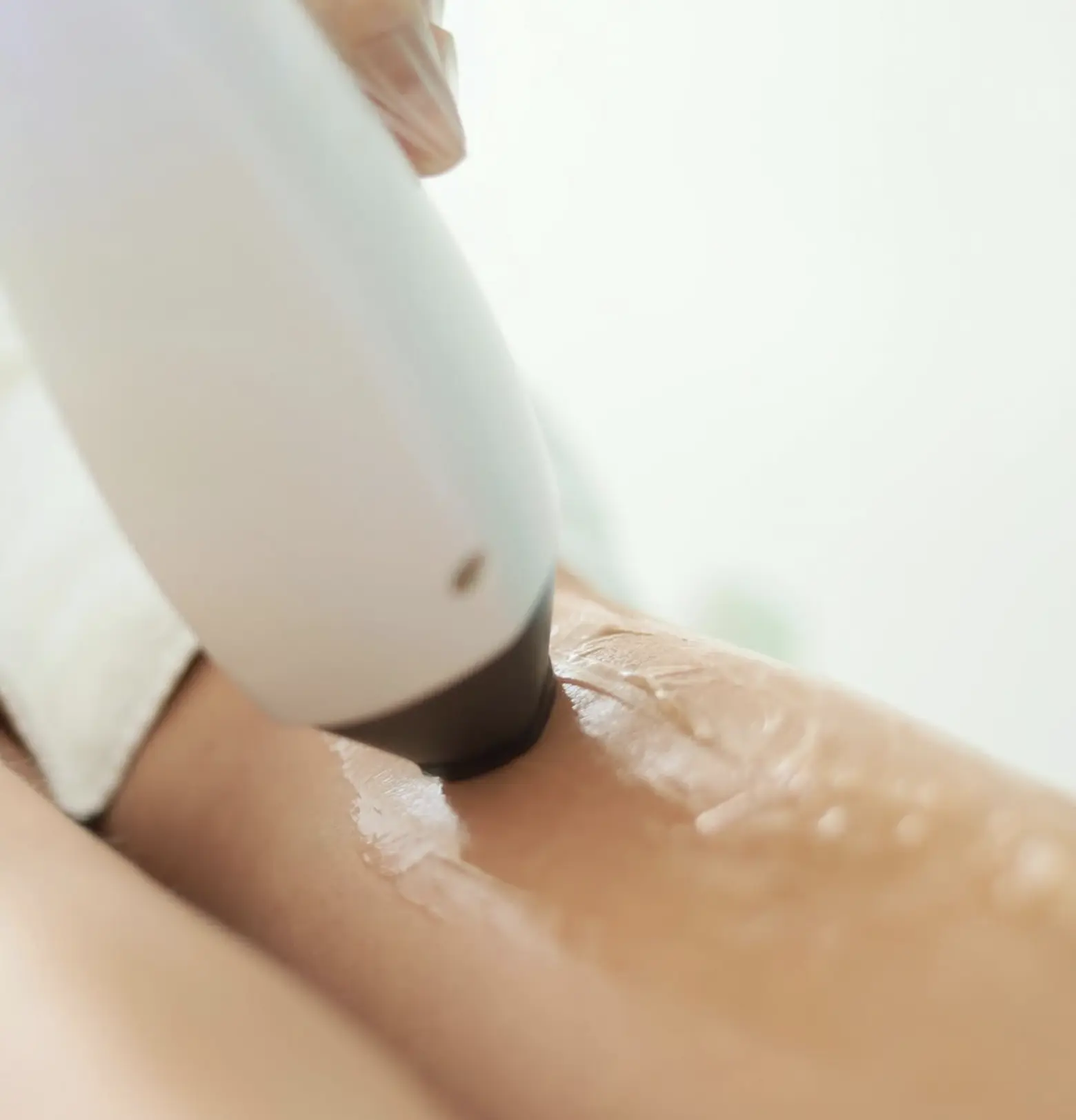 does ipl permanently remove hair