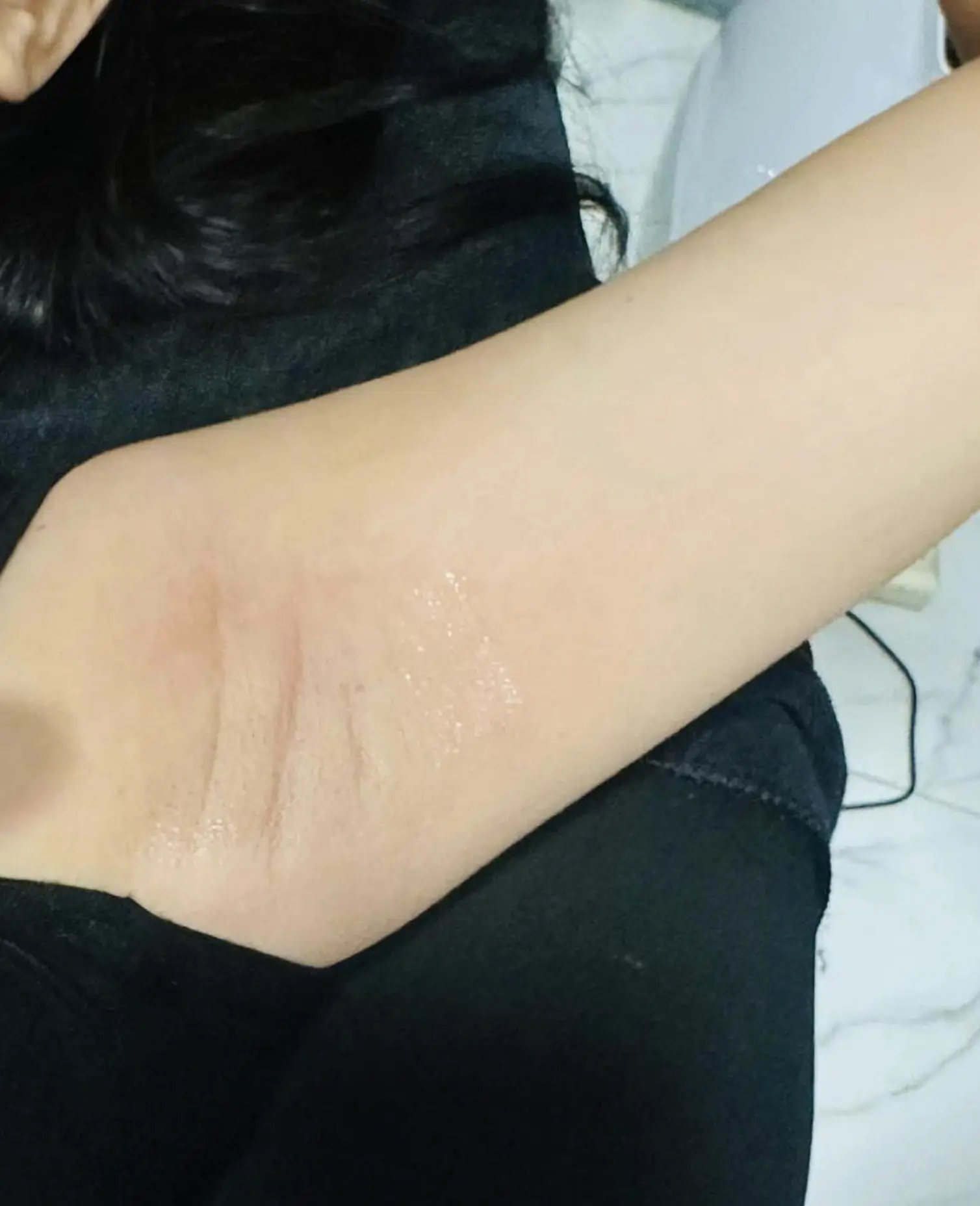 ipl permanent hair reduction